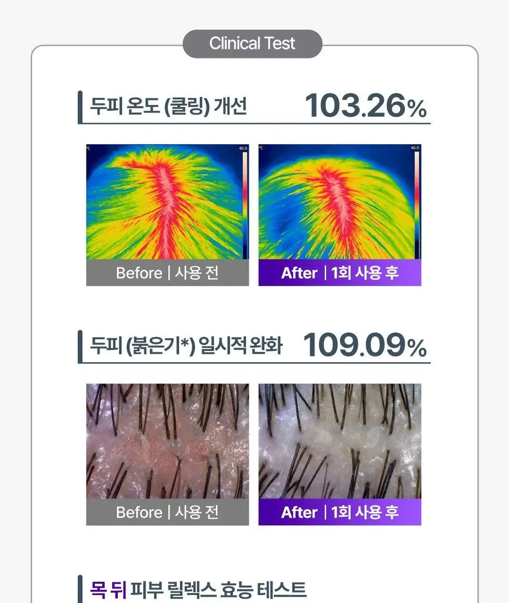 [No.1 헤어/두피 디바이스] 레스노베 하이퍼샷(베이지/핑크) 상세페이지 27